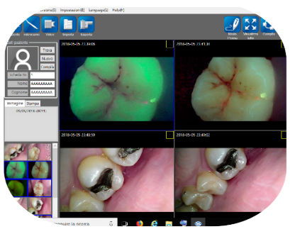 Software di immagineria dentale