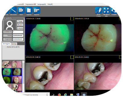 Software di immagineria dentale Software di immagineria dentale